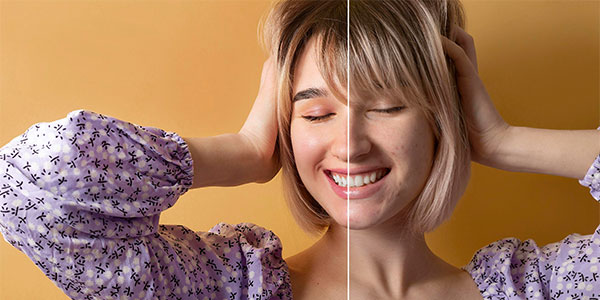 Cilt Tonu Eşitleme Yöntemleri