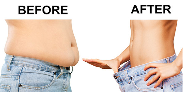 Kilo Almanın ve Kilo Vermenin Cilde Etkisi